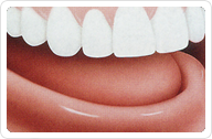 Denture